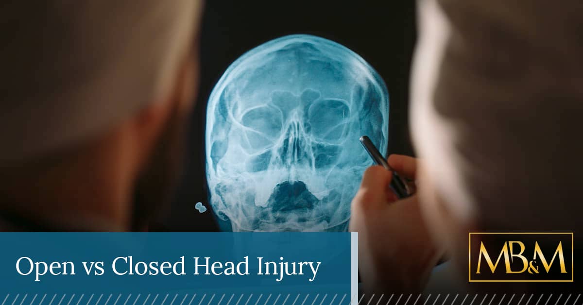 How Do Open and Closed Head Injuries Differ Providence